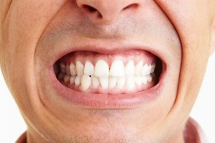 Diş sıkma problemini önemseyin! – İGF HABER