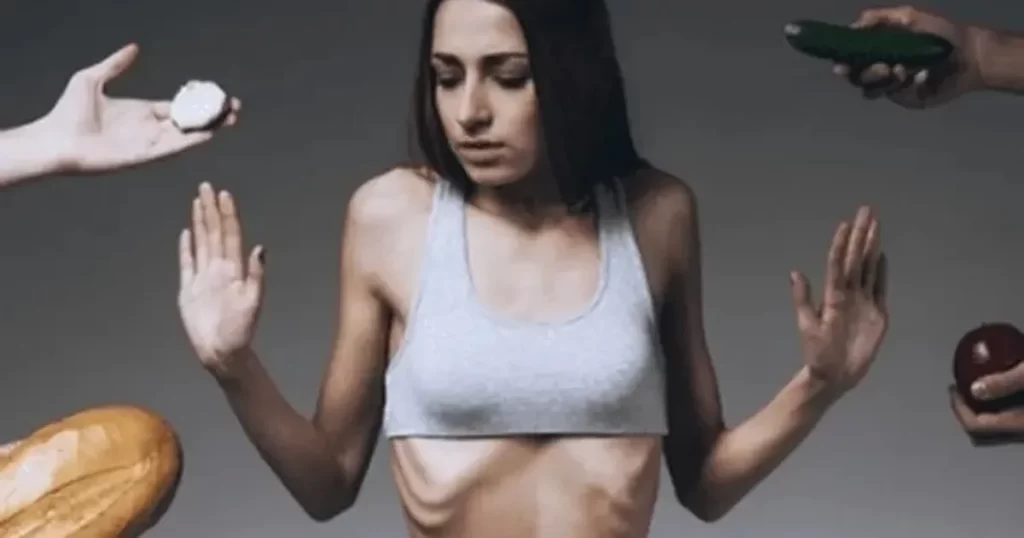 Anoreksiyadan kurtulmak mümkün mü? – İGF HABER